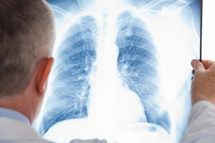 Медики показали на видео легкие курильщика и здорового