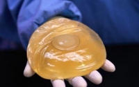 Тысячам француженок бесплатно заменят силиконовые имплантаты