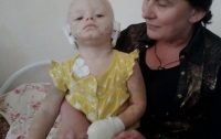 Пес откусил уши ребенку в Харькове