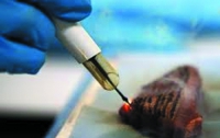 «Умный скальпель» отличает раковые ткани от здоровых