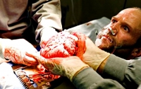 В Украине перекрыт канал доставки человеческих органов «черным трансплантологам»