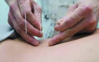 Иглоукалывание поможет забеременеть