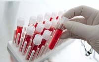 Ученые создали бумагу, которая за секунды определяет группу крови