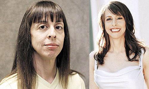 Шедевр, пластическая, хирургия, ФОТО Шедевр, пластическая, хирургия, ФОТО