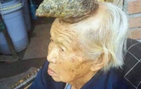 В Китае нашли женщину-единорога