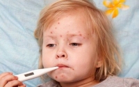 В Запорожской области растет количество больных корью