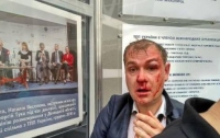 Активисты С14 побили заместителя председателя партии 