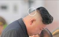 Загадочные пятна на голове Ким Чен Ына переполошили пользователей Сети (фото)