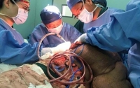 Житель Китая 30 лет прожил с 15-килограммовой опухолью на спине