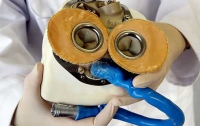 Хирурги впервые имплантировали пациенту искусственное сердце