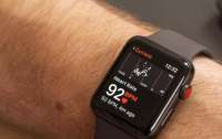Умные часы Apple Watch ставят ложные диагнозы