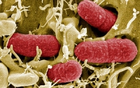 К массовой смерти европейцев привела бактерия-мутант