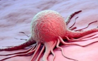 Ученые наши новый способ лечения рака поджелудочной железы