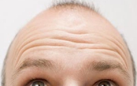 Ученые открыли уникальное средство от облысения
