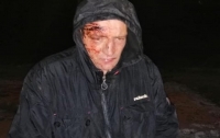 Жители Днепра устроили самосуд над насильником, который избивал девушку