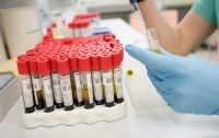 В Британии проведут первые в истории медицины испытания искусственной крови
