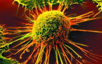 Ученые нашли способ лечения рака на последней стадии