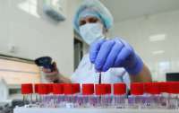 В Украине начинают исследовать препараты, которые могут бороться с коронавирусом
