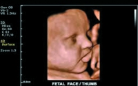 Лицо будущего ребенка покажет УЗИ