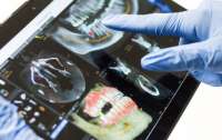 В Японии тестируют первый в мире препарат для регенерации зубов