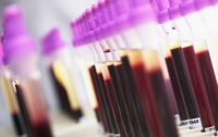 iPhone теперь умеет обрабатывать анализ крови