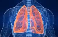 Как распознать пневмонию по первым признакам