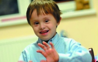 Ученые стали ближе к излечению синдрома Дауна