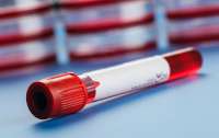 Ученые придумали, как предсказать риск развития лейкемии по анализу крови