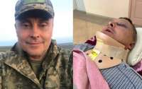 У Чорноморську п’ятеро чоловіків побили військового