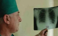В Мариуполе 22% детей инфицированы туберкулезом