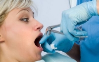 Американка умерла после удаления 16 зубов у стоматолога