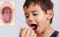 Врачи предупредили о возможной вспышке дифтерии