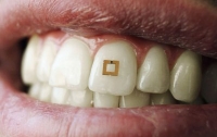 Ученые создали зубной датчик, который будет контролировать питание