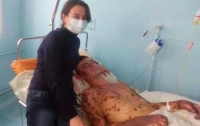 Родители просят спасти сына от невиданной в Украине болезни (фото)