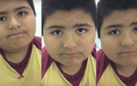 Мальчик проглотил свисток и начал свистеть при каждом вздохе (видео)