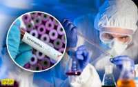 Институт биологии клетки НАНУ за 10 млн гривен создает украинскую вакцину против коронавируса