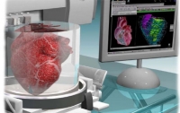 В США людям пересаживают органы, напечатанные на 3D-принтерах