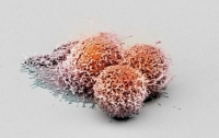 Ученые обнаружили белок подавляющий развитие рака