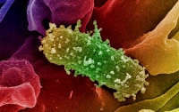 От E.coli умерла первая француженка 