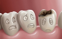 Плохие зубы могут спровоцировать многие болезни