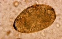Ученые обнаружили паразитов в печени мумии