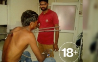 Куски арматуры застряли в шее у индийского байкера после аварии (ФОТО)