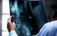 Ученые доказали разрушительное воздействие рентгеновских лучей на кости