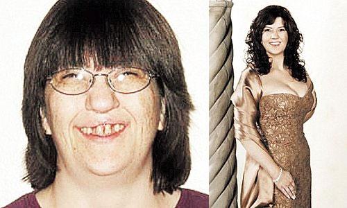 Шедевр, пластическая, хирургия, ФОТО Шедевр, пластическая, хирургия, ФОТО