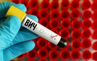 Ученые выявили способ защиты от ВИЧ