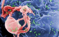 Вирус оказался эффективным борцом с ВИЧ
