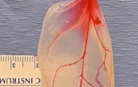 Ученые создали из шпината ткани человеческого сердца (видео)