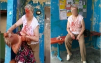 Две пенсионерки устроили кровавую драку в Житомире