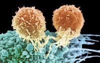 Врачи разработали новый уникальный способ лечения рака