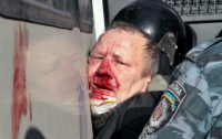 В больницах Киева остаются 150 пострадавших в столкновениях 